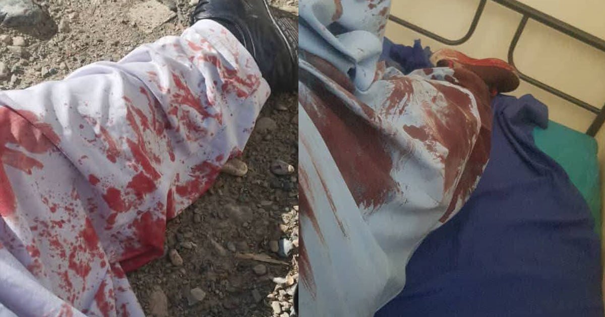 سه خبرنگار افغانستان در حملات نظامیان پاکستانی زخمی شدند