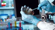 Una rivoluzione nella diagnosi del cancro gastrointestinale con un kit iraniano