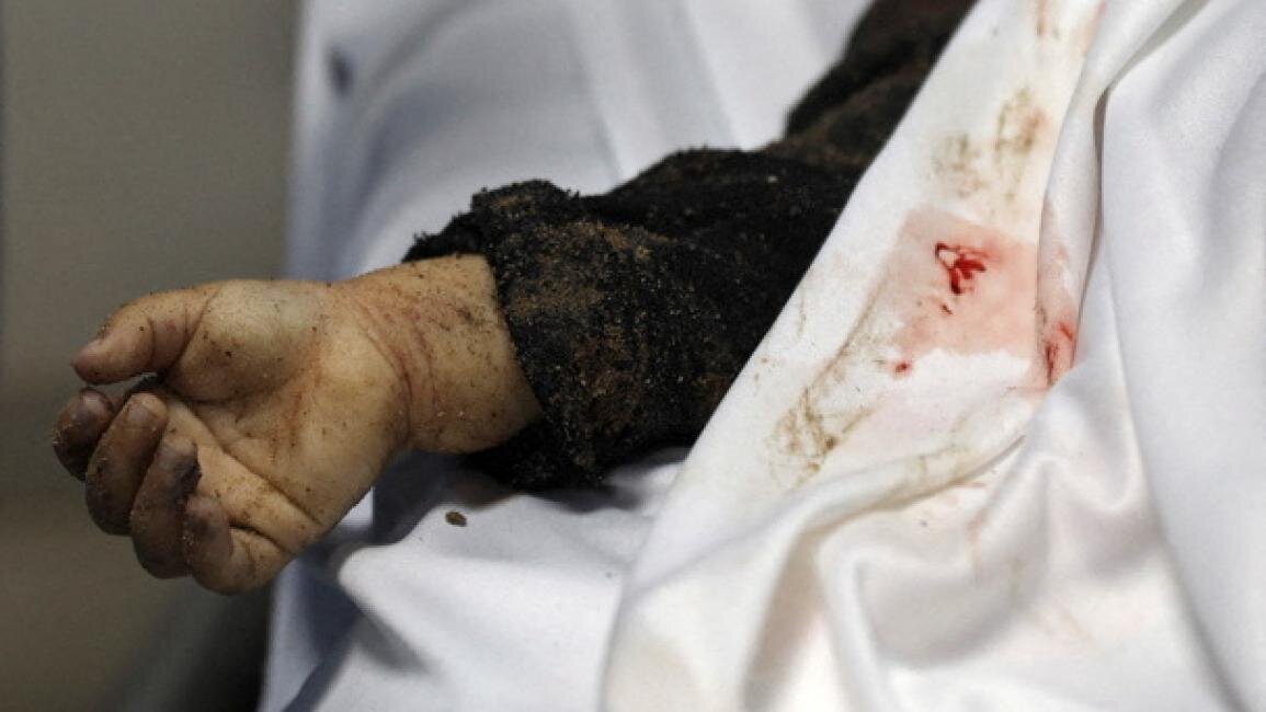 Idadi ya Mashahidi wa Mauaji ya Kimbari ya Israel huko Gaza imezidi Mashahidi elfu ۵۰