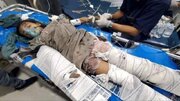 Отчет ЮНИСЕФ о мученической смерти восьми йеменских детей в результате атак США