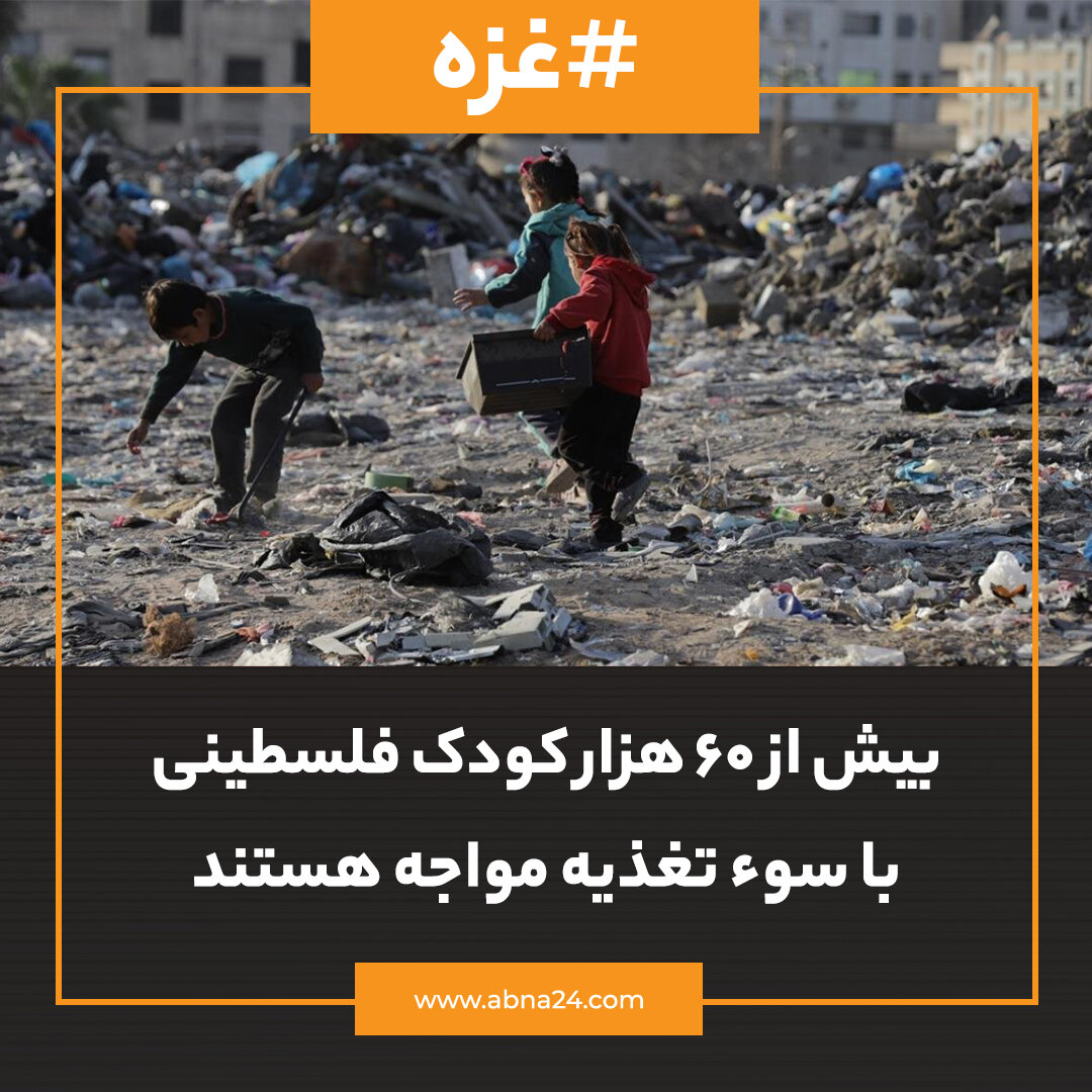 عکس خبری | بیش از ۶۰ هزار کودک فلسطینی با سوءتغذیه مواجه هستند