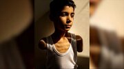 Criança amputada em Gaza vence o prêmio de Foto do Ano