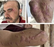 Israelíes utilizan productos químicos para torturar a presos palestinos