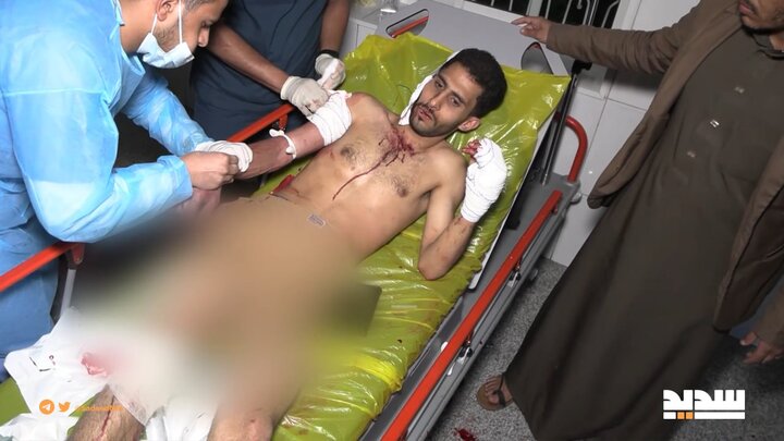 مشاهد من المجزرة التي ارتكبها العدو الأمريكي على حي وسوق فروة الشعبي في صنعاء