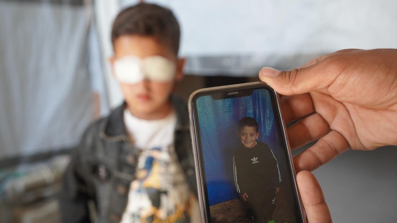 مهمات عملنکرده اسرائیلی چشم کودک فلسطینی را گرفت + تصاویر