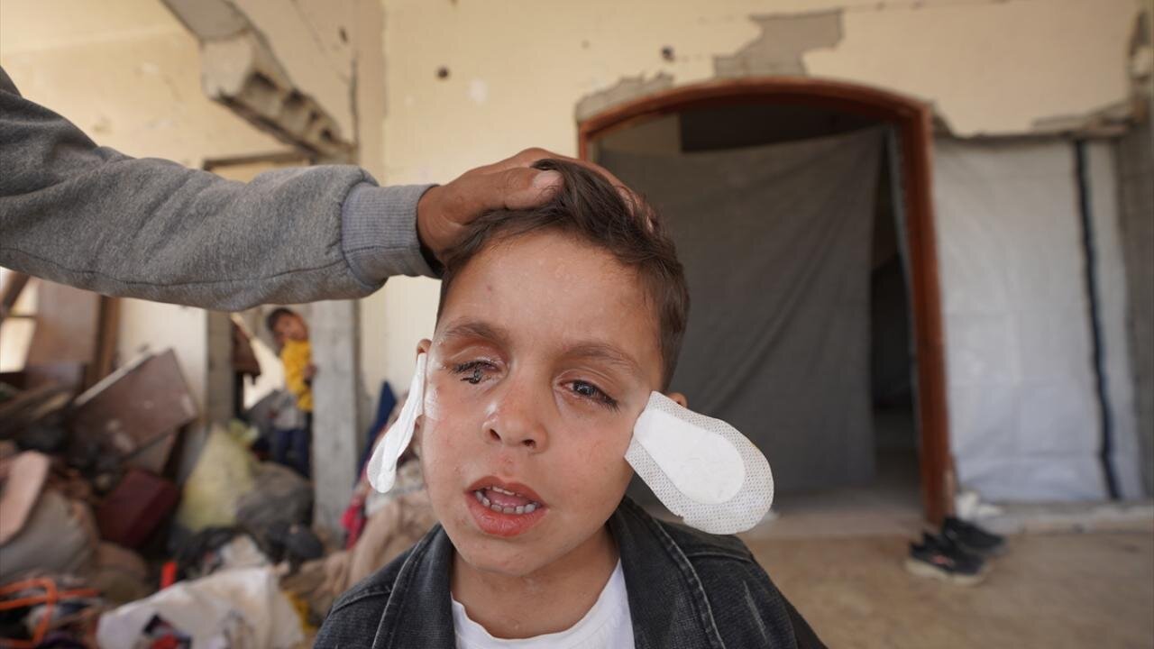 مهمات عملنکرده اسرائیلی چشم کودک فلسطینی را گرفت + تصاویر