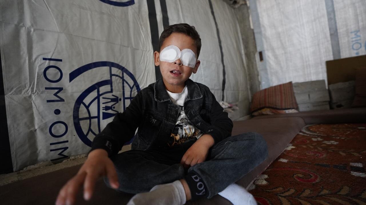 مهمات عملنکرده اسرائیلی چشم کودک فلسطینی را گرفت + تصاویر