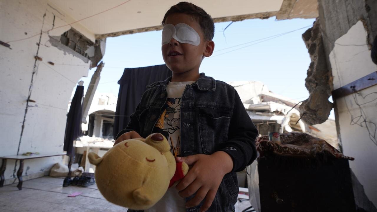 مهمات عملنکرده اسرائیلی چشم کودک فلسطینی را گرفت + تصاویر