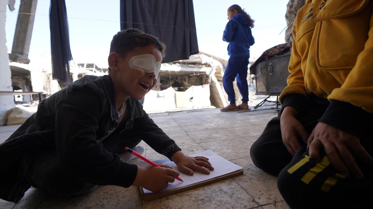 مهمات عملنکرده اسرائیلی چشم کودک فلسطینی را گرفت + تصاویر