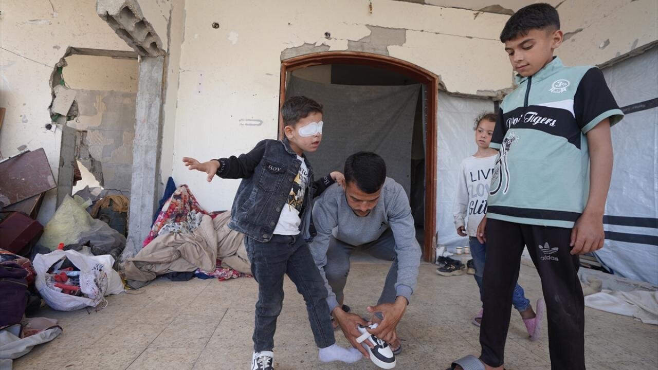 مهمات عملنکرده اسرائیلی چشم کودک فلسطینی را گرفت + تصاویر