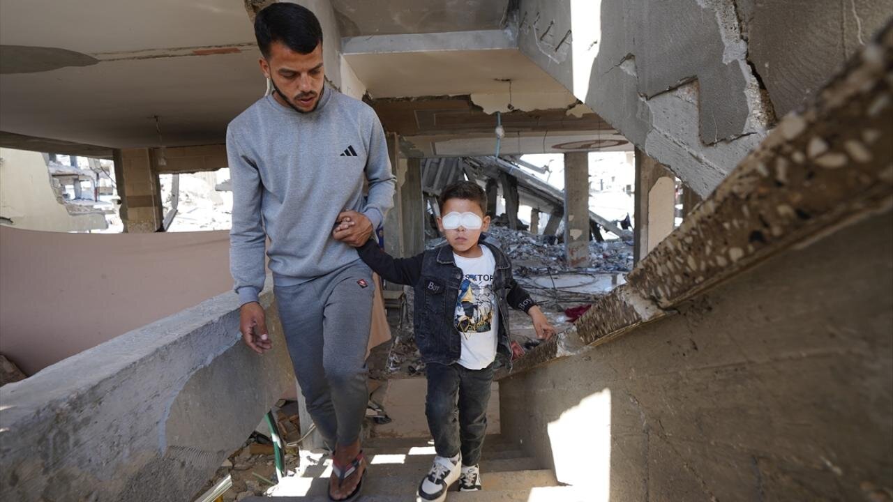 مهمات عملنکرده اسرائیلی چشم کودک فلسطینی را گرفت + تصاویر