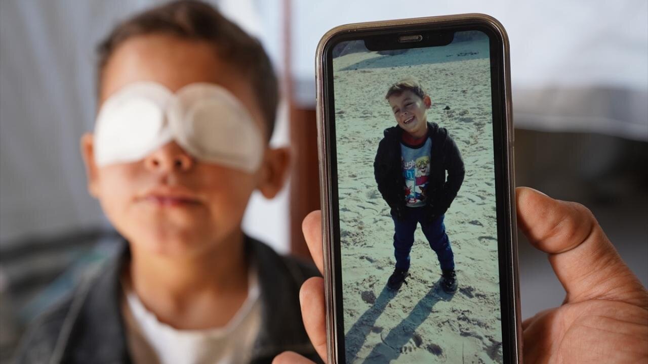 مهمات عملنکرده اسرائیلی چشم کودک فلسطینی را گرفت + تصاویر