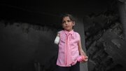 Photos: Palestinian girl clinging to life with one hand