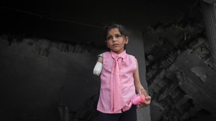 Photos: Palestinian girl clinging to life with one hand