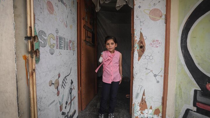 Photos: Palestinian girl clinging to life with one hand