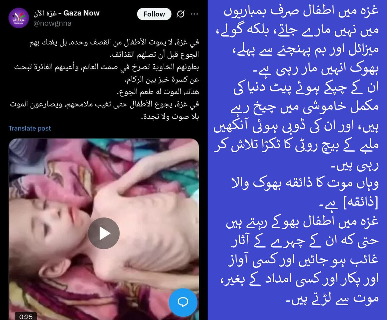 تصویری خبر | غزہ کے بچوں کے چپکے ہوئے پیٹ "دنیا کی مکمل خاموشی میں" چیخ رہے ہیں