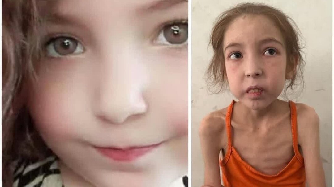 دنیا کے بھونڈے پن نے تیرے بچپن کی خوبصورتیوں کو بگاڑ کیوں دیا؟ + تصویریں اور ویڈیوز
