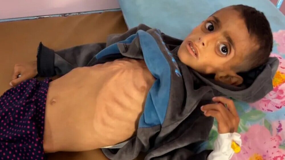 دنیا کے بھونڈے پن نے تیرے بچپن کی خوبصورتیوں کو بگاڑ کیوں دیا؟ + تصویریں اور ویڈیوز