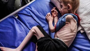 Israel mata crianças palestinas com armas ou pela fome