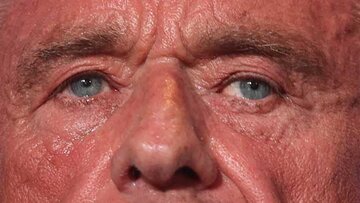 Genosida Ala Trump-Kennedy; AS Berubah Jadi Laboratorium Modern Pemurnian Ras?