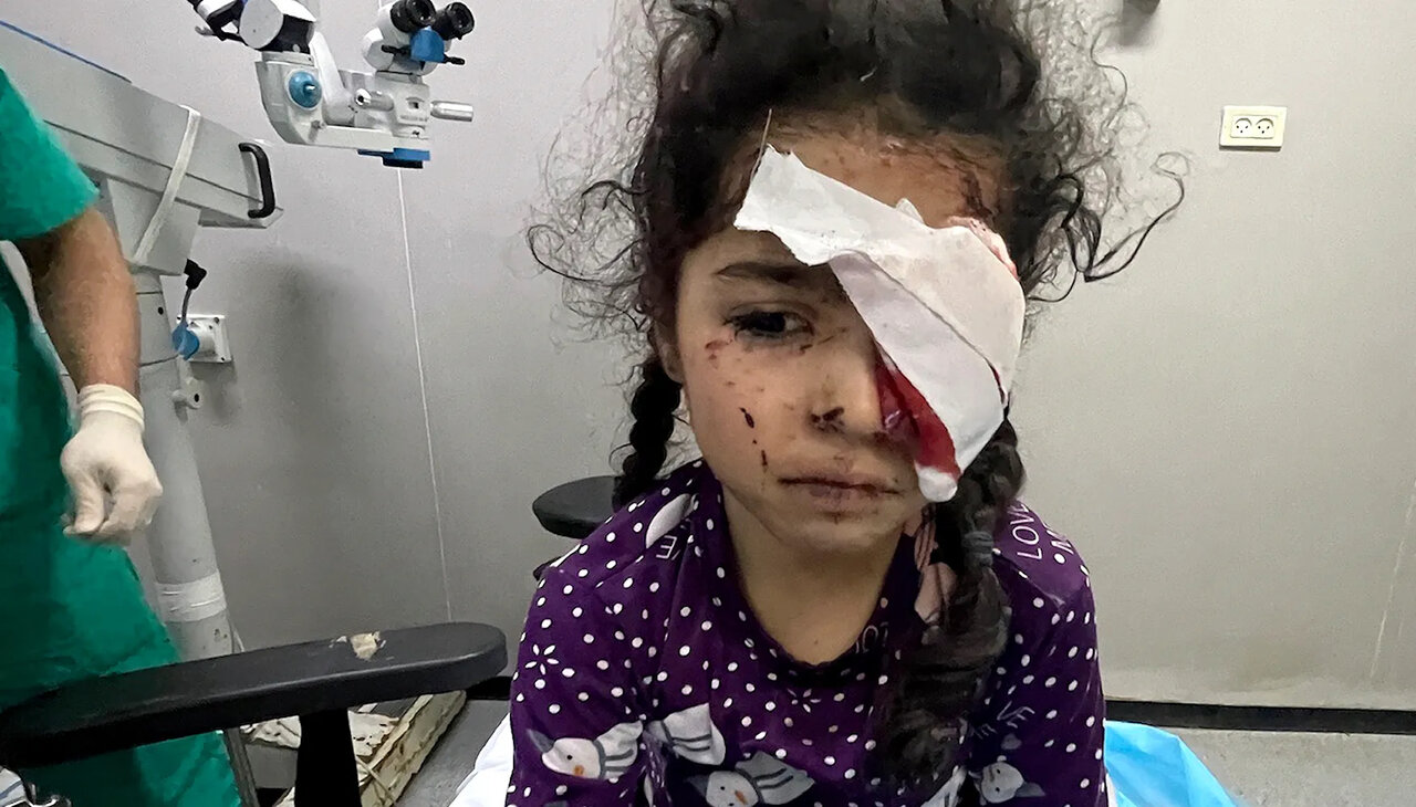 Gaza eye hospital near collapse as war leaves 1,500 blind