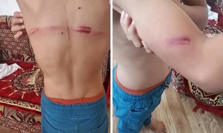 Calls for independent investigation into child abuse at Marib’s Quran center