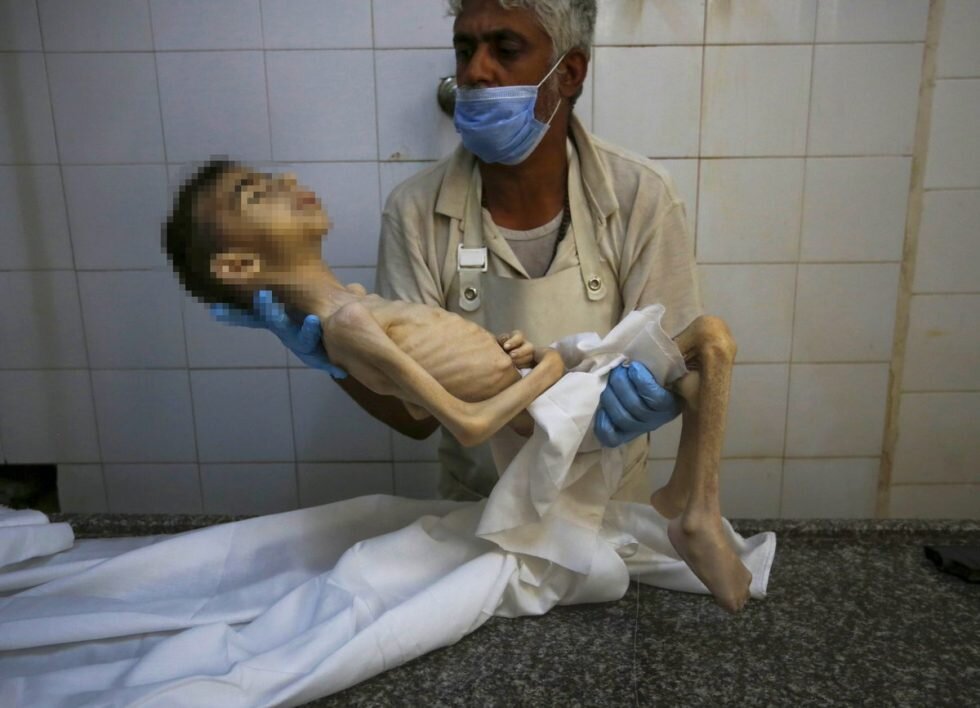 WFP warns of severe malnutrition affecting 70,000 children in Gaza