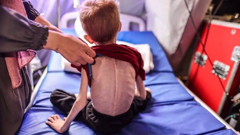 Four-year-old Palestinian child dies of malnutrition due to Israeli blockade