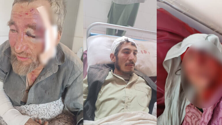 درگیری کوچی‌ها با شیعیان در شهرستان بهسود افغانستان