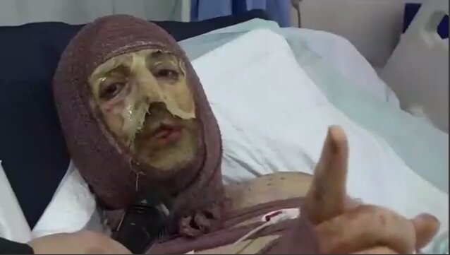 ویدیو | مصاحبه جانبازان ارتش در حملات اخیر / به خاطر قسمی که خوردیم پای این مردم و آب و خاک ایستادیم