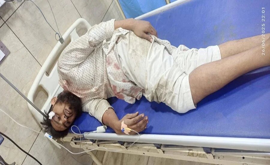 Islamophobia: Muslim Youth Brutally Attacked in Haridwar, India
