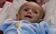 UNICEF: Milhares de bebês em Gaza sofrem de desnutrição e falta de acesso à nutrição adequada