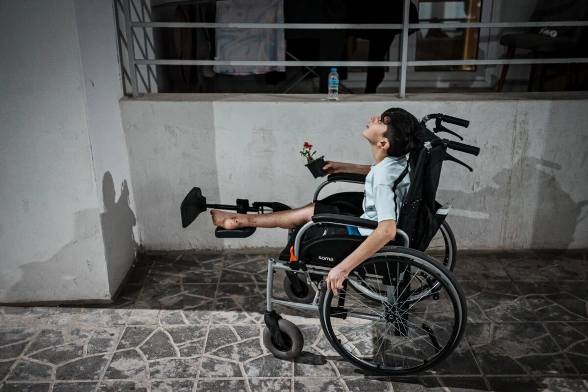 At least 10 Palestinian kids lose their legs every day in Israeli strikes