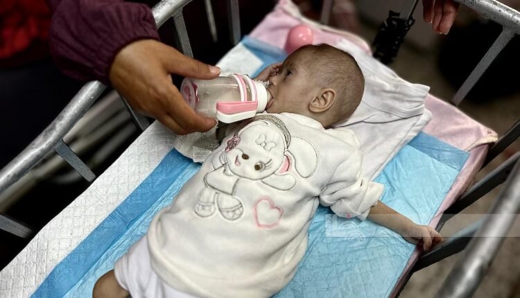 UNRWA: One in 10 children screened in our medical facilities is malnourished in Gaza