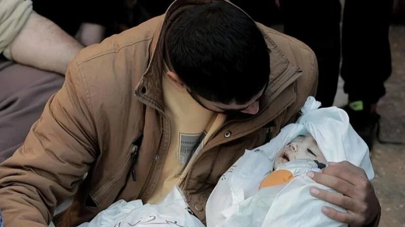 Palestinian infants seriously harmed in war that Zionist regime has launched in Gaza Strip