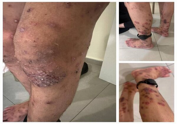 Bin Guvîr: Ez serbilind im ku min girtiyên Filistînî ji xwarinê bêpar hiştin