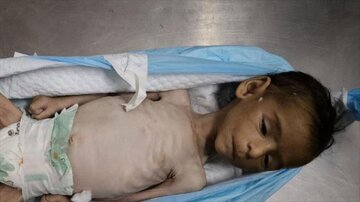 Regime sionista mata três crianças em Gaza em um único dia usando a fome como arma
