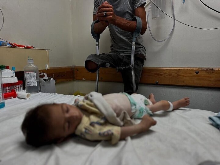 قحطی در غزه؛ فجیع‌ترین جنایت گرسنگی در دوره معاصر + تصاویر