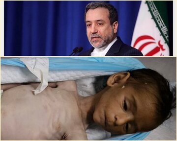 Araghchi: Shambulizi la Israel kwa Wanaotafuta Msaada wa Chakula Gaza ni Uhalifu wa Vita wa Dhahiri