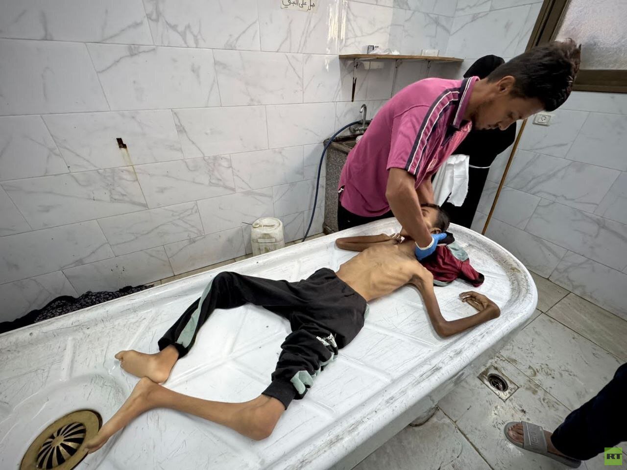 ضحايا الجوع في غزة: وفاة أطفال وطاقم طبي ينهار في مجمع الشفاء