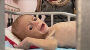 100-dən çox hüquq və yardım təşkilatı Qəzzədə aclıq böhranına qarşı təcili tədbir görülməsini tələb etdi - FOTO