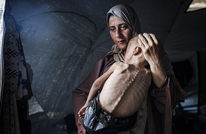 تفطر القلوب غزة.. أطفال لا يستطيعون البكاء من شدة الجوع ويموتون بين يدي ذويهم وعالم يراقب بفزع وجزع