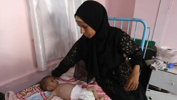 Crise alimentar em Gaza agrava saúde da população