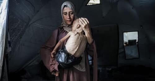 Gaza hospitals face collapse as infant nutrition crisis deepens