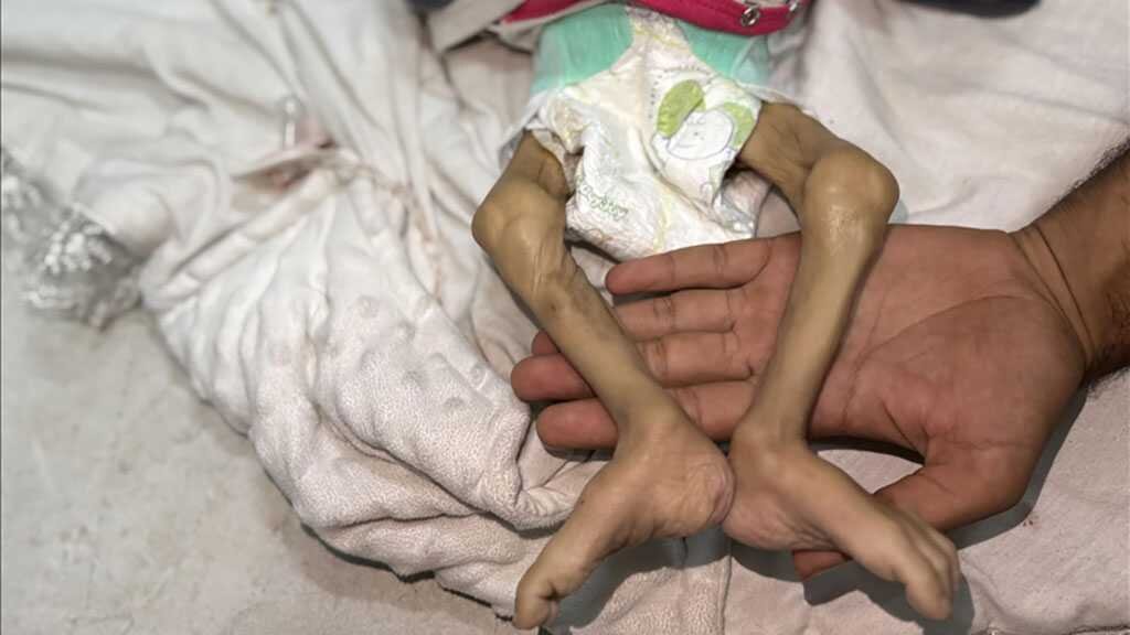 Gaza facing mass child deaths as Israel starves over 100k infants