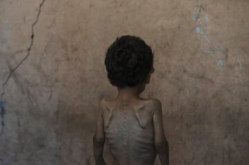 Gaza muere en la garra del hambre israelí-estadounidense: el grito de los niños hambrientos en el silencio del mundo