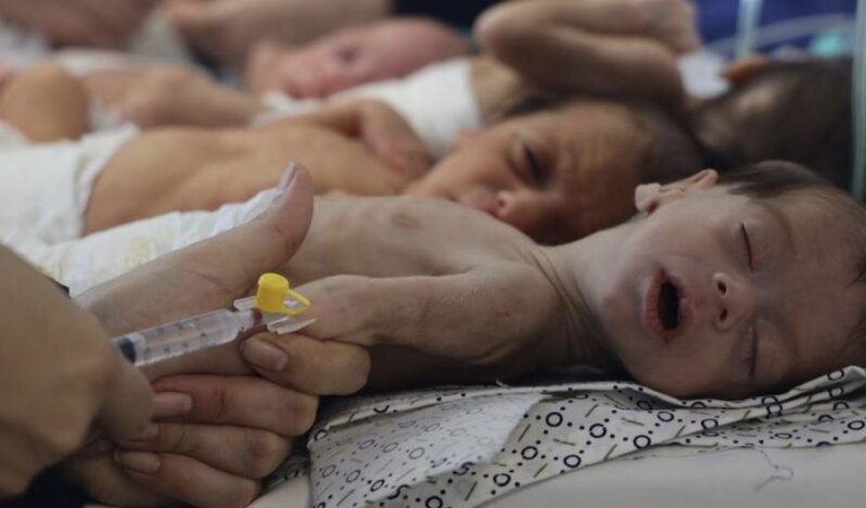 Gazze'de bir bebek daha açlıktan yaşamını yitirdi