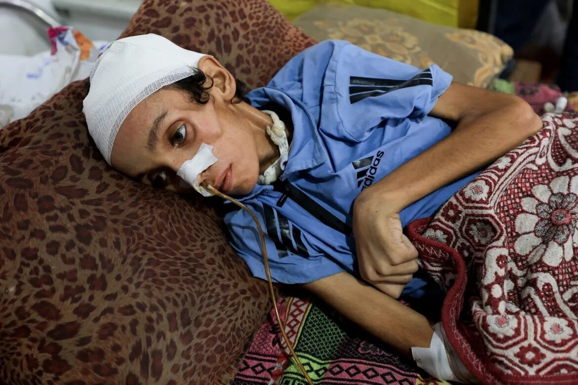 Dr. Barsh Gesa Tindakan Segera Untuk Selamatkan Nyawa di Gaza