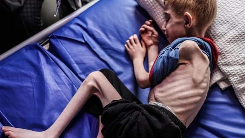 Aç Doktorlar, Kemikli Çocuklar; Batı Gazze’deki Çocuk Katillerinin Yanında