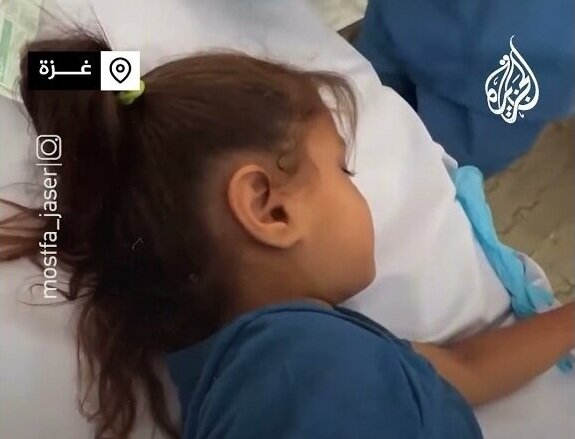 کودک فلسطینی با وجود اصابت گلوله به سرش زنده ماند + ویدیو